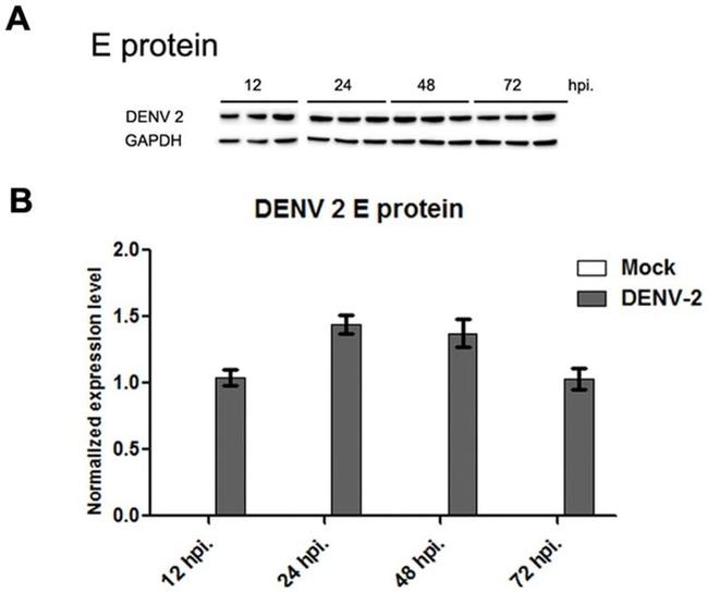 Dengue Virus Type 1-4 Antibody in Western Blot (WB)