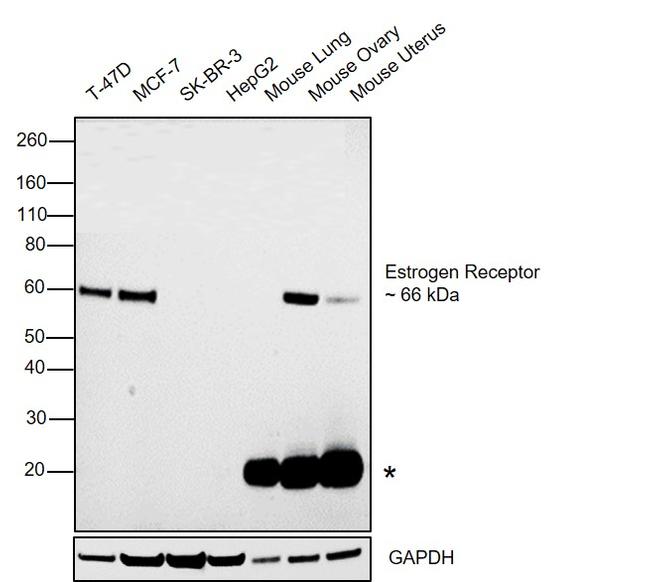 Estrogen Receptor alpha Antibody in Western Blot (WB)