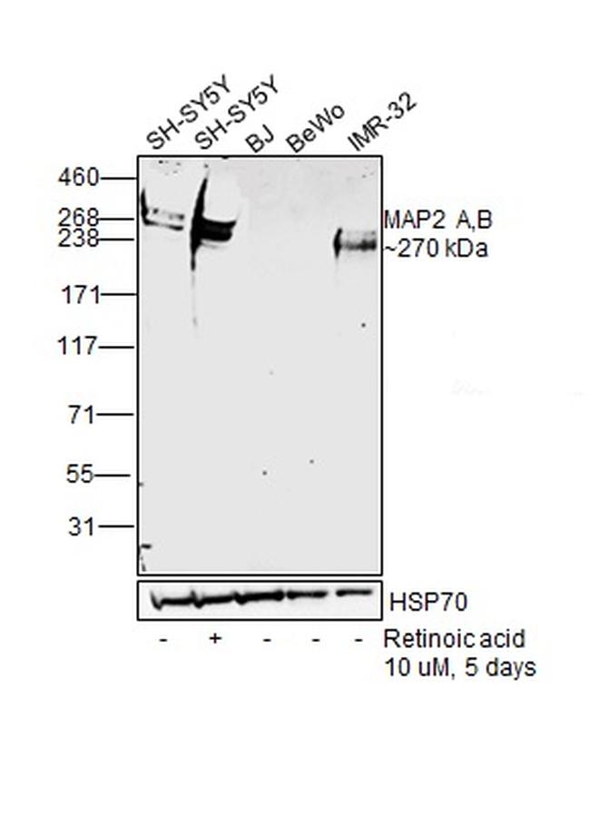 MAP2 Antibody in Western Blot (WB)