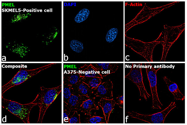 PMEL Antibody in Immunocytochemistry (ICC/IF)