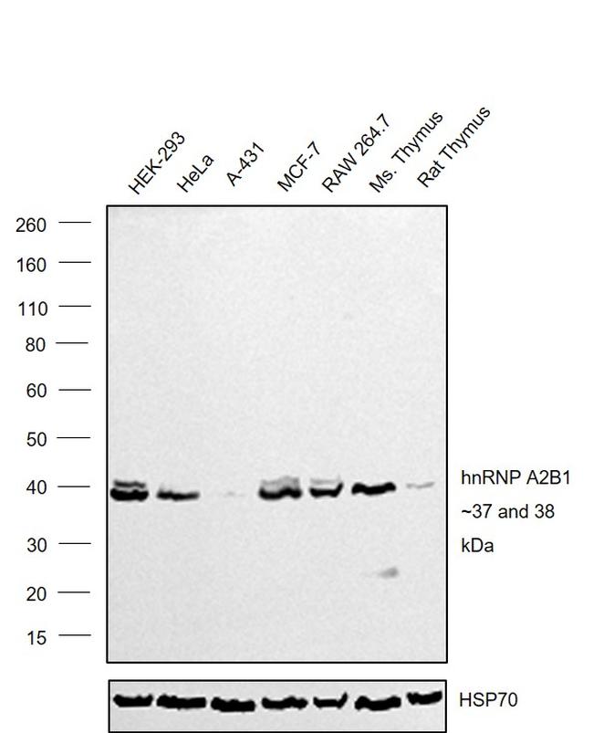 hnRNP A2B1 Antibody in Western Blot (WB)