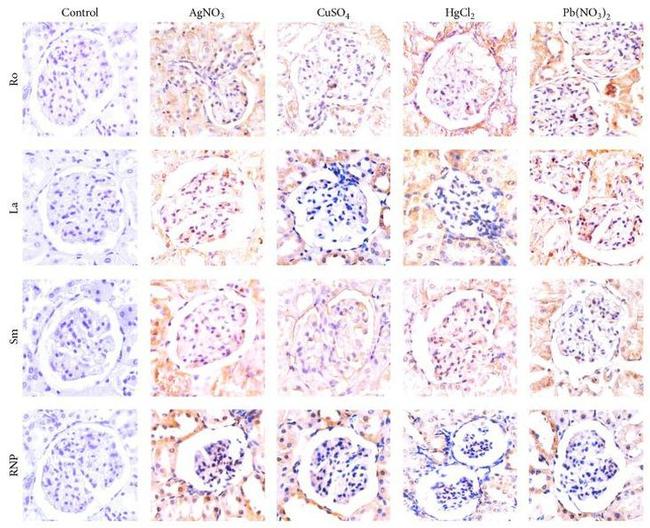 SNRPB Antibody in Immunohistochemistry (Frozen) (IHC (F))