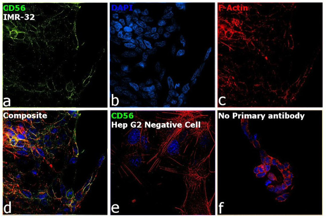 CD56 Antibody