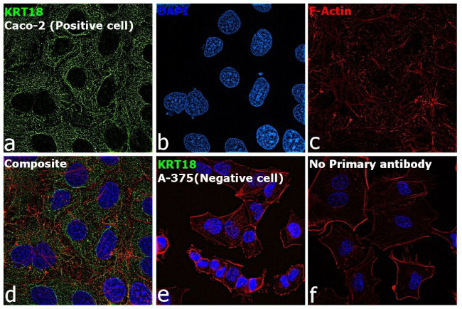 Cytokeratin 18 Antibody in Immunocytochemistry (ICC/IF)