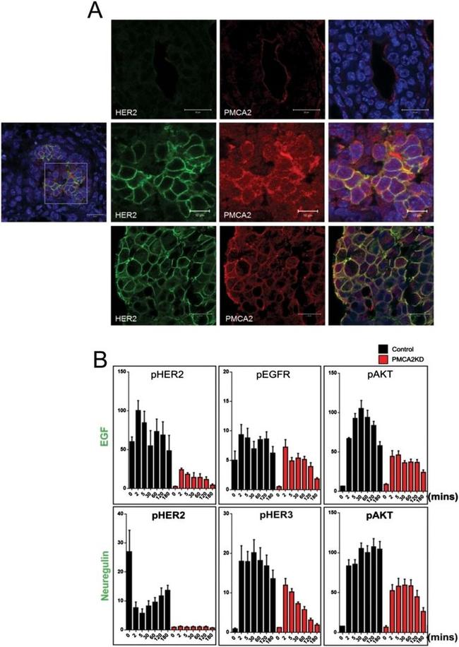 PMCA2 ATPase Antibody in Immunocytochemistry (ICC/IF)