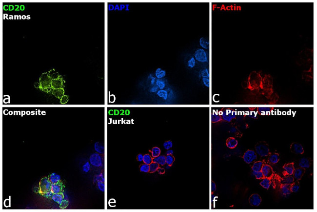 CD20 Antibody in Immunocytochemistry (ICC/IF)