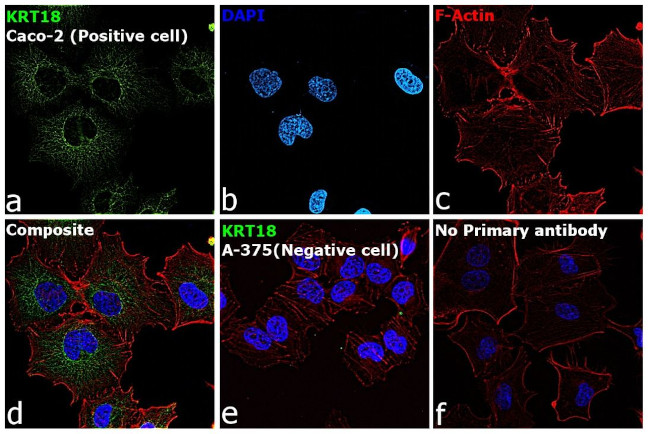 Cytokeratin 18 Antibody in Immunocytochemistry (ICC/IF)