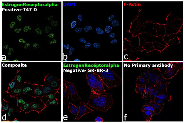 Estrogen Receptor alpha Antibody