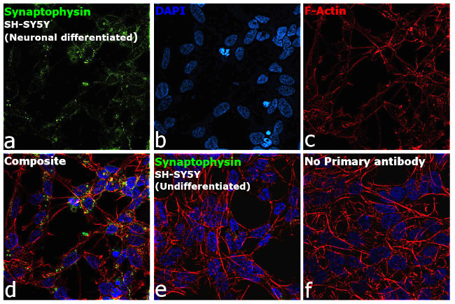 Synaptophysin Antibody in Immunocytochemistry (ICC/IF)