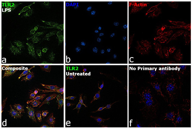 TLR2 Antibody in Immunocytochemistry (ICC/IF)