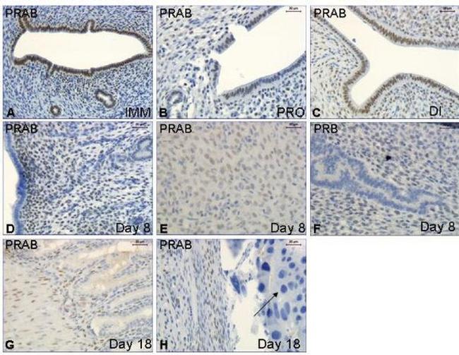 Progesterone Receptor Antibody in Immunohistochemistry (IHC)