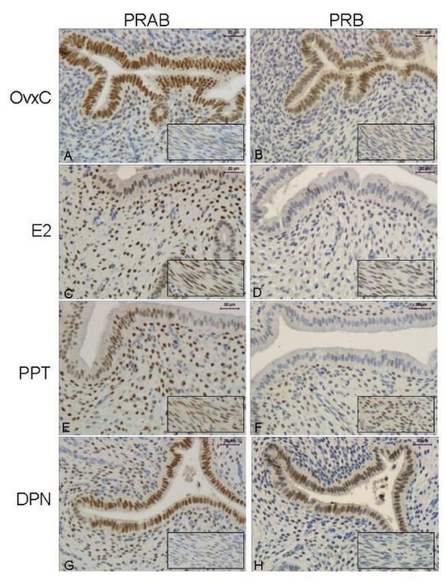 Progesterone Receptor Antibody in Immunohistochemistry (IHC)