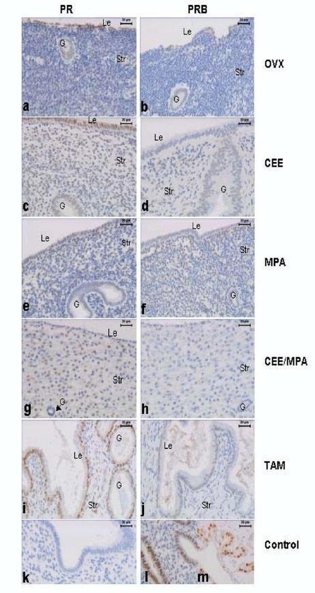 Progesterone Receptor Antibody in Immunohistochemistry (IHC)