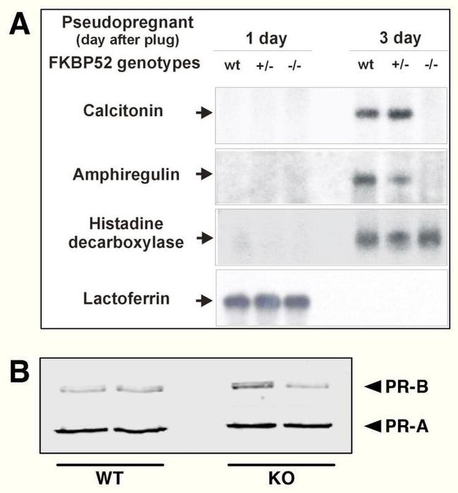 Progesterone Receptor Antibody in Western Blot (WB)