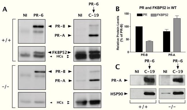 Progesterone Receptor Antibody in Western Blot (WB)