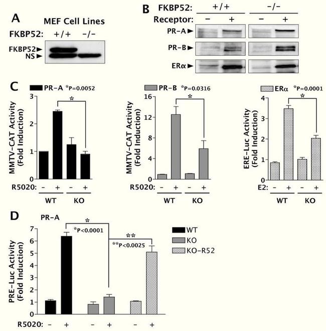 Progesterone Receptor Antibody in Western Blot (WB)