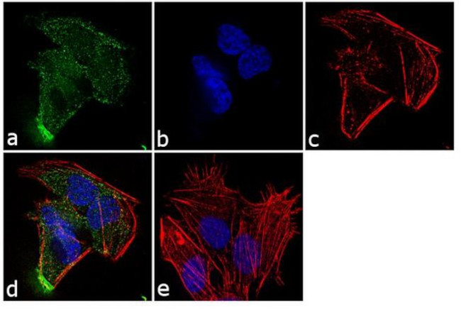 AKT3 Antibody in Immunocytochemistry (ICC/IF)