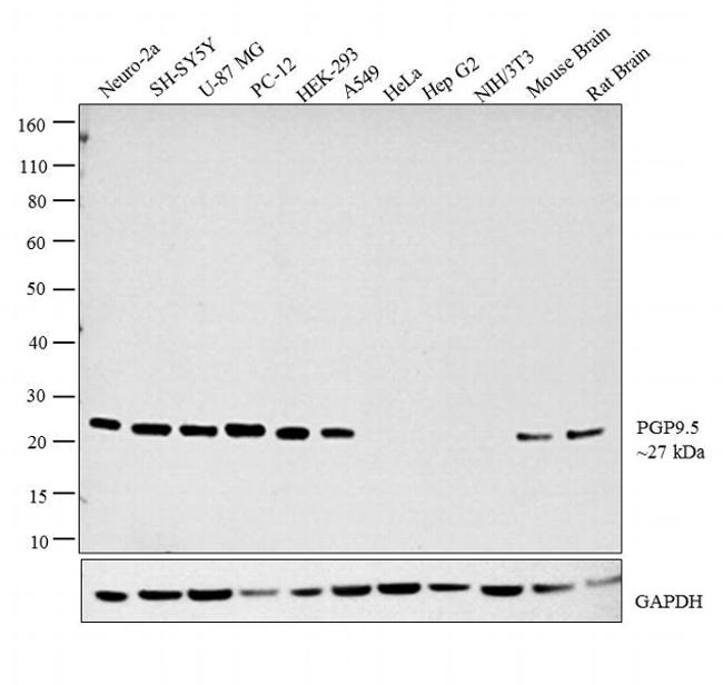 PGP9.5 Antibody in Western Blot (WB)