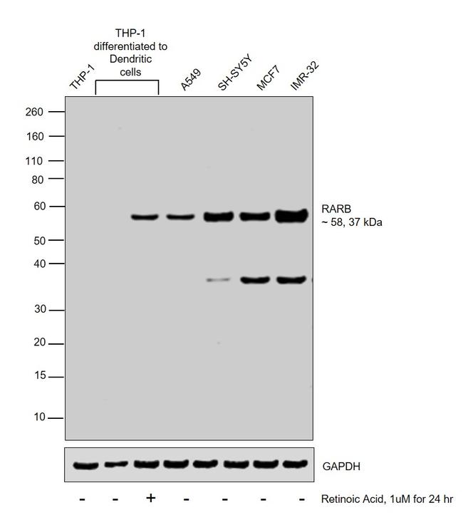 RARB Antibody in Western Blot (WB)