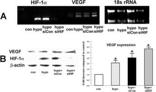 HIF1A Antibody in Western Blot (WB)