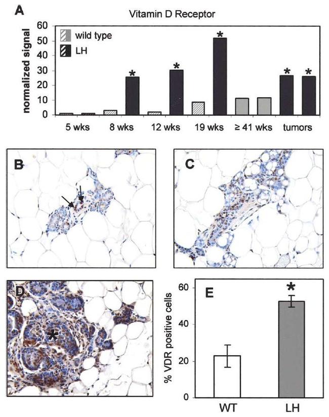 VDR Antibody in Immunohistochemistry (IHC)