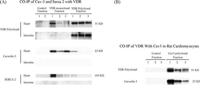VDR Antibody in Western Blot, Immunoprecipitation (WB, IP)