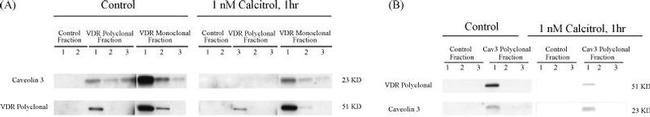 VDR Antibody in Immunoprecipitation (IP)