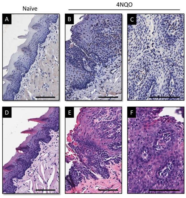 VDR Antibody in Immunohistochemistry (Paraffin) (IHC (P))