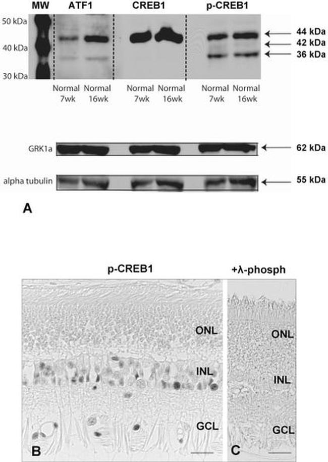 GRK1 Antibody in Western Blot (WB)