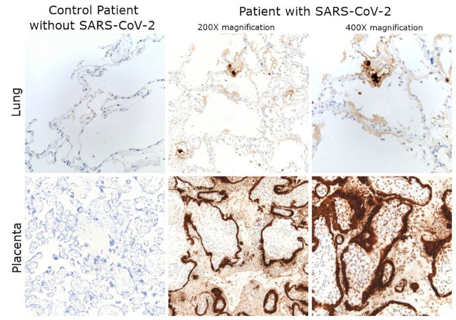 SARS/SARS-CoV-2 Nucleocapsid Antibody