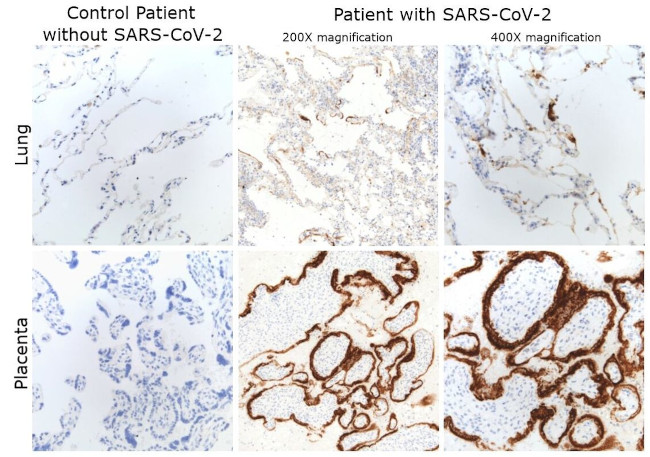 SARS/SARS-CoV-2 Nucleocapsid Antibody in Immunohistochemistry (IHC)