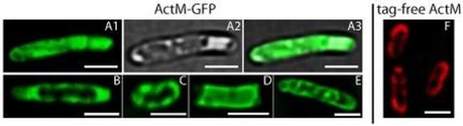 Actin Antibody in Immunocytochemistry (ICC/IF)