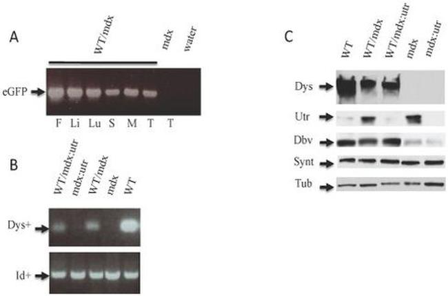 SNTB2 Antibody in Western Blot (WB)