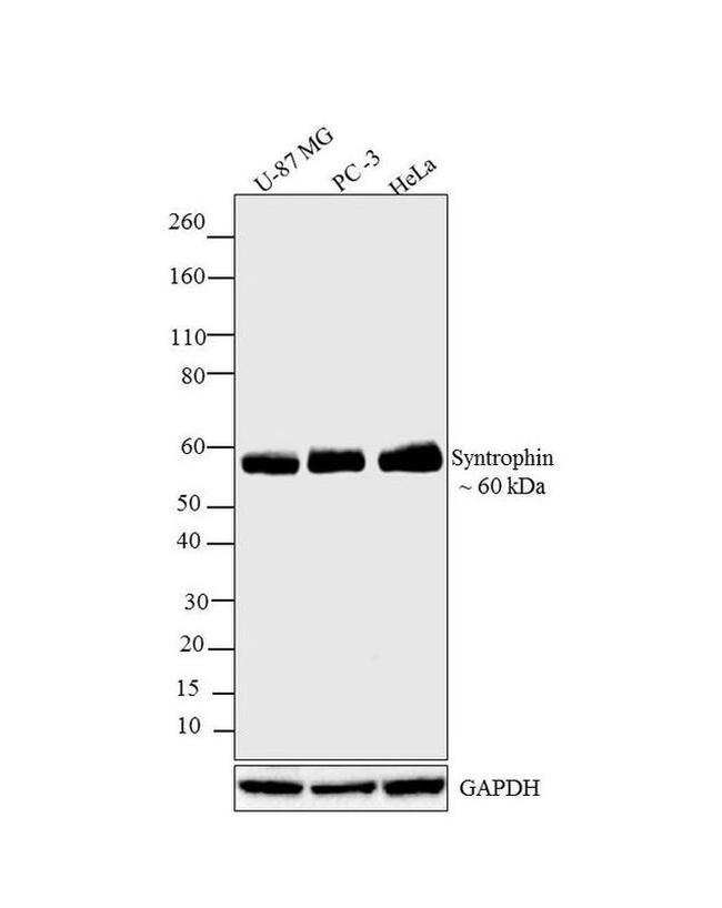 SNTB2 Antibody in Western Blot (WB)