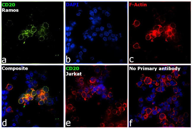 CD20 Antibody in Immunocytochemistry (ICC/IF)