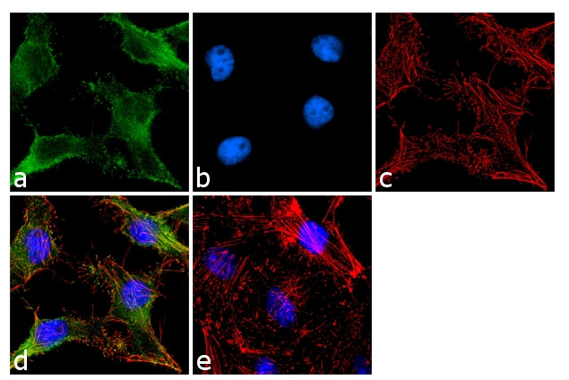 TIMP1 Antibody in Immunocytochemistry (ICC/IF)