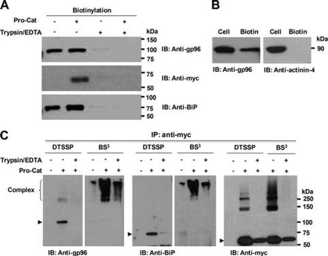 alpha Actinin 4 Antibody in Western Blot (WB)