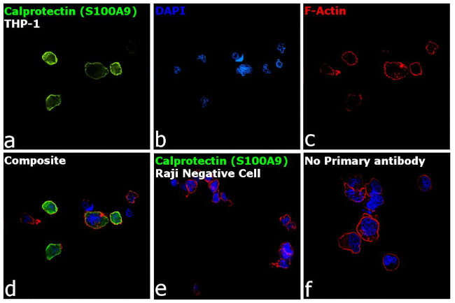 Calprotectin Antibody