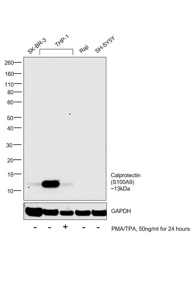 Calprotectin Antibody in Western Blot (WB)