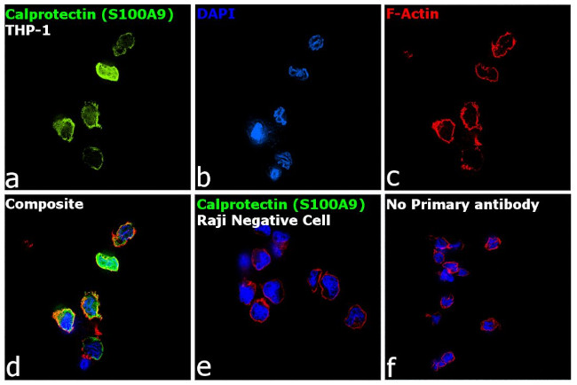 Calprotectin Antibody