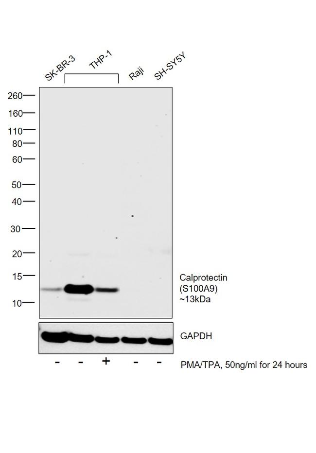 Calprotectin Antibody in Western Blot (WB)