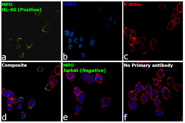 Myeloperoxidase Antibody