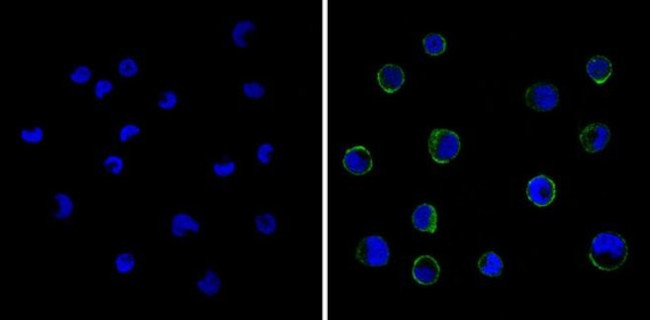 CD18 Antibody in Immunocytochemistry (ICC/IF)