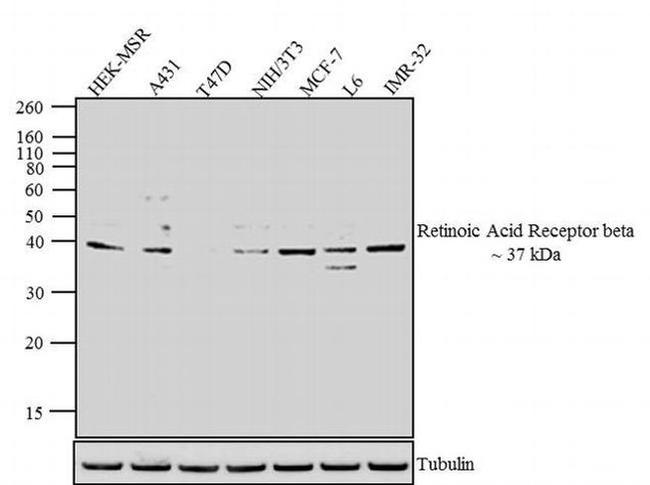 RARB Antibody in Western Blot (WB)