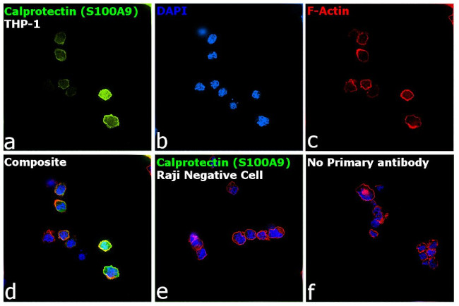 Calprotectin Antibody