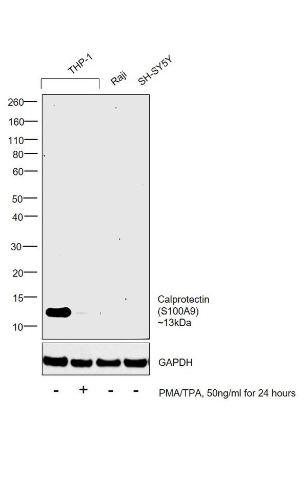 Calprotectin Antibody