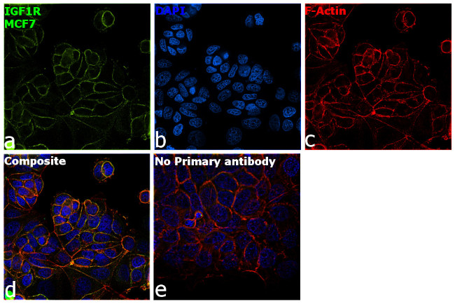 IGF1R alpha Antibody in Immunocytochemistry (ICC/IF)