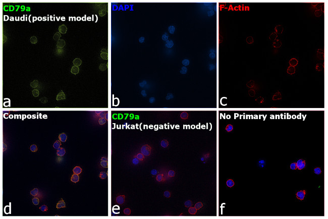 CD79a Antibody in Immunocytochemistry (ICC/IF)