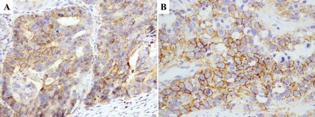 CD44v6 Antibody in Immunohistochemistry (Paraffin) (IHC (P))