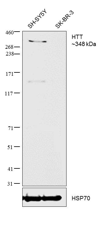 Huntingtin Antibody